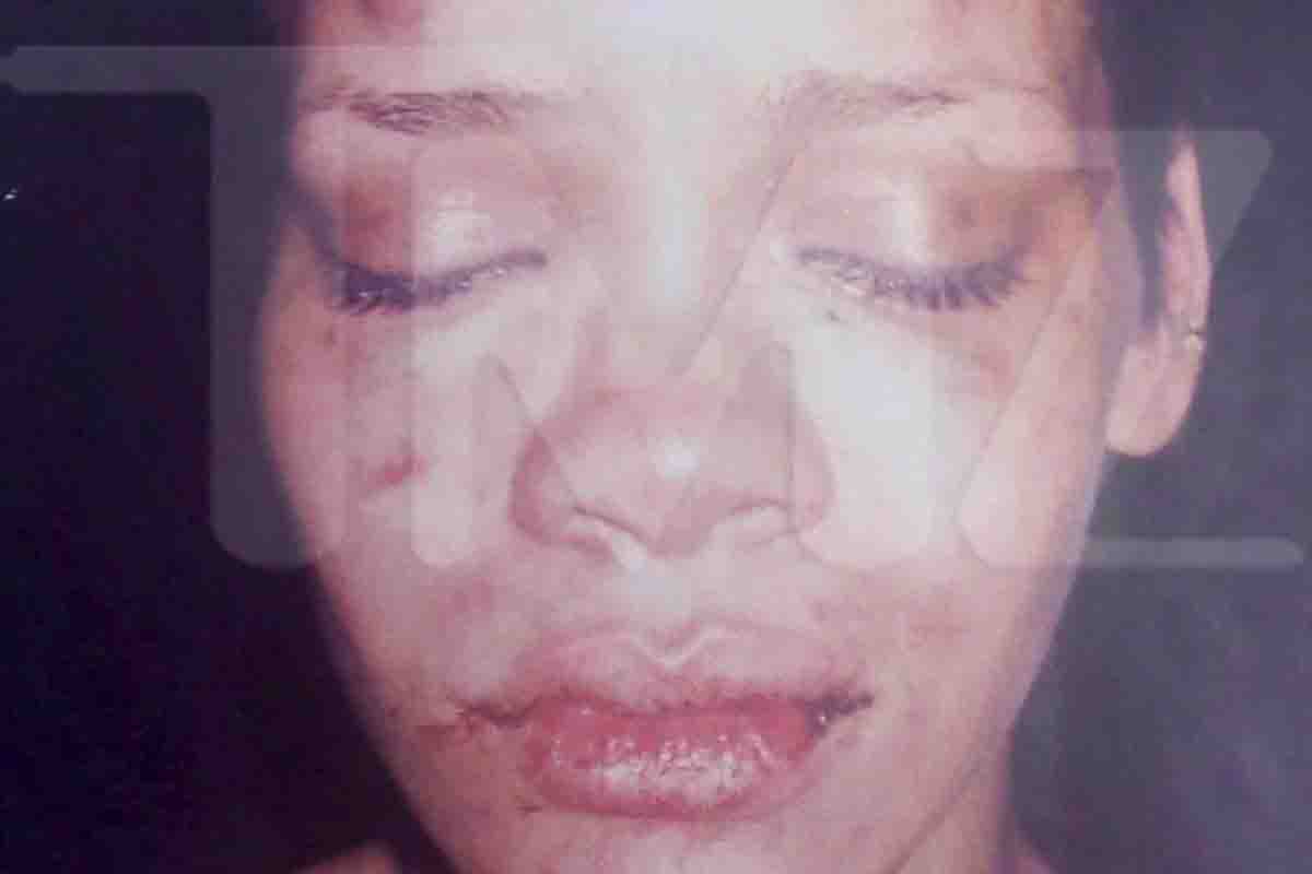 La tremenda foto del volto sfigurato di Rihanna dopo la lite con Brown 